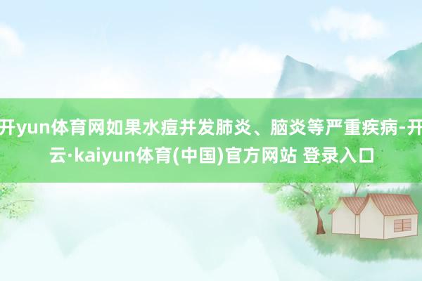 开yun体育网如果水痘并发肺炎、脑炎等严重疾病-开云·kaiyun体育(中国)官方网站 登录入口